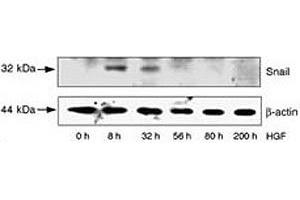 Image no. 2 for anti-SNAIL (SNAI1) (AA 9-39) antibody (ABIN3032657)