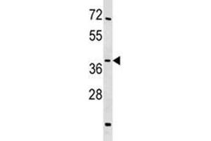 Image no. 2 for anti-Sirtuin 4 (SIRT4) (AA 67-95) antibody (ABIN3032593)