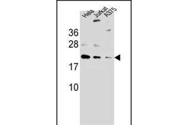 ARL6IP6 anticorps  (N-Term)