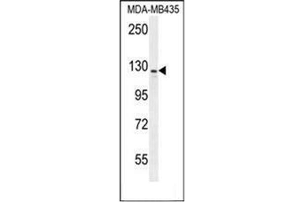 IBTK antibody  (Middle Region)