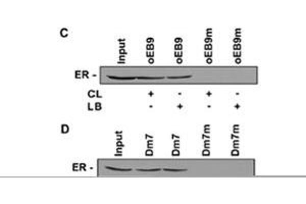 Estrogen Receptor 1 (ESR1) (Transcript Variant 1) protein (Myc-DYKDDDDK Tag)