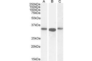 Image no. 1 for anti-Actin Related Protein 2/3 Complex, Subunit 2, 34kDa (ARPC2) (C-Term) antibody (ABIN184748)