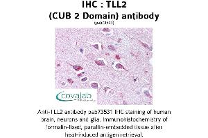 Image no. 1 for anti-Tolloid-Like 2 (TLL2) antibody (ABIN1740102)