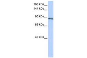 Image no. 1 for anti-Small Optic Lobes Homolog (SOLH) (AA 1008-1057) antibody (ABIN6742789)