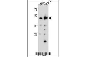 Image no. 1 for anti-Aspartyl Aminopeptidase (DNPEP) (AA 38-65), (N-Term) antibody (ABIN655795)