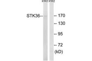 Image no. 1 for anti-serine/threonine Kinase 36 (STK36) (AA 387-436) antibody (ABIN1535333)