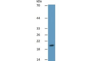Image no. 3 for Peroxisome Proliferator-Activated Receptor gamma (PPARG) ELISA Kit (ABIN6574233)