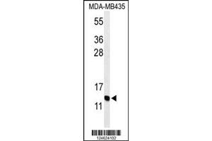 Image no. 1 for anti-Gonadotropin-Releasing Hormone 2 (GnRH2) (Center) antibody (ABIN2437763)