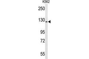 Image no. 2 for anti-Transcriptional Regulating Factor 1 (TRERF1) (AA 1143-1172), (C-Term) antibody (ABIN955327)