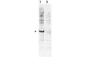 Western blot using  Affinity Purified anti-APC6 pT580 antibody shows detection of a band ~72 kDa corresponding to phosphorylated human APC6 (arrowhead lane 1).