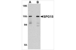 Image no. 1 for anti-Zinc Finger, FYVE Domain Containing 26 (ZFYVE26) (C-Term) antibody (ABIN783824)