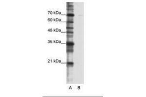 Image no. 1 for anti-Cleavage Stimulation Factor, 3' Pre-RNA, Subunit 2, 64kDa, tau Variant (CSTF2T) (AA 521-570) antibody (ABIN6736229)