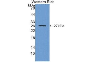 Image no. 1 for anti-Galactosamine (N-Acetyl)-6-Sulfate Sulfatase (GALNS) (AA 168-377) antibody (ABIN2117341)