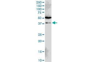 Image no. 1 for anti-E3 Ubiquitin-Protein Ligase SIAH1 (SIAH1) (AA 1-110) antibody (ABIN520188)
