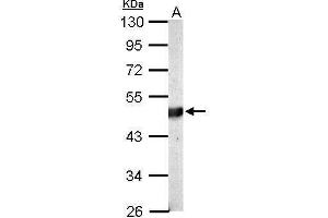 Image no. 1 for anti-Branched Chain Ketoacid Dehydrogenase Kinase (BCKDK) (Center) antibody (ABIN2855837)