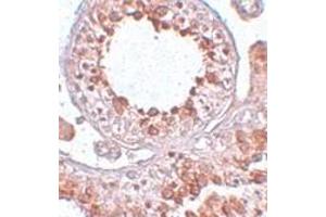 Image no. 1 for anti-ESX Homeobox 1 (ESX1) (Center) antibody (ABIN499804)
