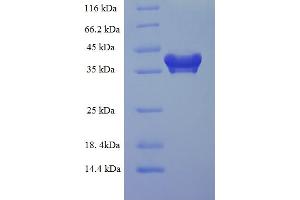 PDCD10 Protein (AA 1-212, full length) (His-SUMO Tag)