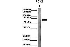 Image no. 3 for anti-phosphoenolpyruvate Carboxykinase 1 (Soluble) (PCK1) (Middle Region) antibody (ABIN2777602)