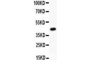 Image no. 1 for anti-TEK Tyrosine Kinase, Endothelial (TEK) (AA 641-830) antibody (ABIN3043418)