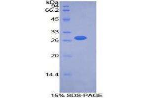 Image no. 1 for Pyruvate Dehydrogenase Kinase, Isozyme 2 (PDK2) protein (ABIN3011409)