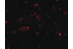 Image no. 2 for anti-SLIT and NTRK-Like Family, Member 2 (SLITRK2) (Internal Region) antibody (ABIN6656785)