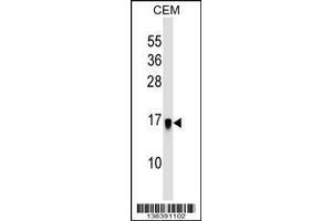 Image no. 1 for anti-Galectin-Related Protein (GRP) (AA 101-129) antibody (ABIN1537713)