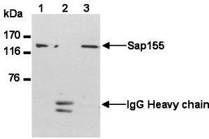 Image no. 2 for anti-Splicing Factor 3b, Subunit 1, 155kDa (SF3B1) (AA 98-198) antibody (ABIN1449241)