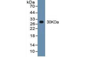 Rabbit Capture antibody from the kit in WB with Positive Control: HepG2 cell lysate.