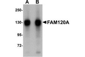 Image no. 1 for anti-Family with Sequence Similarity 120A (FAM120A) (Middle Region) antibody (ABIN1030930)