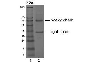 Image no. 1 for anti-Acid Phosphatase, Prostate (ACPP) antibody (ABIN238332)