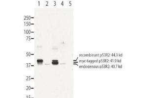 Image no. 1 for anti-Ribonucleotide Reductase M2 B (TP53 Inducible) (RRM2B) (N-Term) antibody (ABIN964915)