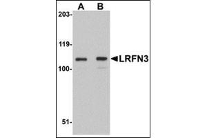 Image no. 2 for anti-Leucine Rich Repeat and Fibronectin Type III Domain Containing 3 (LRFN3) (Center) antibody (ABIN500190)