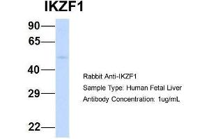 Image no. 2 for anti-IKAROS Family Zinc Finger 1 (Ikaros) (IKZF1) (Middle Region) antibody (ABIN2777317)