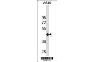 Image no. 1 for anti-Glycine Amidinotransferase (L-Arginine:glycine Amidinotransferase) (GATM) (AA 350-378), (C-Term) antibody (ABIN1881365)