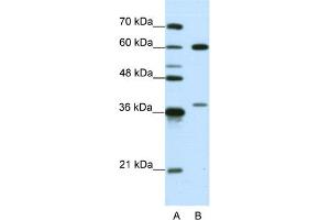 anti-Heterogeneous Nuclear Ribonucleoprotein L (HNRNPL) (N-Term) antibody