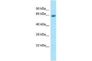Image no. 1 for anti-Arylsulfatase J (ARSJ) (C-Term) antibody (ABIN2790605)