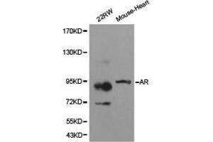 anti-Androgen Receptor (AR) antibody