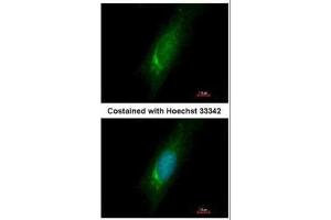 Image no. 2 for anti-Homer Homolog 3 (Drosophila) (HOMER3) (Center) antibody (ABIN2856993)