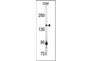 Image no. 2 for anti-ADAM Metallopeptidase with Thrombospondin Type 1 Motif, 13 (ADAMTS13) (AA 836-866) antibody (ABIN359601)