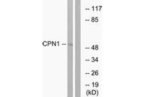 Image no. 1 for anti-Carboxypeptidase N Subunit 1 (CPN1) (AA 409-458) antibody (ABIN1534736)