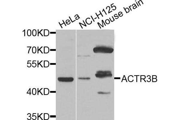 anti-ARP3 Actin-Related Protein 3 Homolog B (ACTR3B) antibody