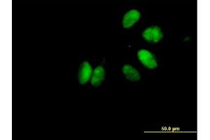 Immunofluorescence of purified MaxPab antibody to CHEK2 on HeLa cell.