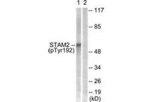 Western blot analysis of extracts from NIH-3T3 cells treated with EGF 200ng/ml 30', using STAM2 (Phospho-Tyr192) Antibody.