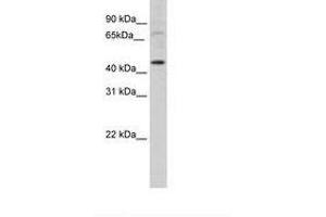 Image no. 1 for anti-LIM Homeobox Transcription Factor 1, alpha (LMX1A) (AA 301-350) antibody (ABIN202392)