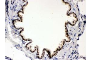 Image no. 2 for anti-Bone Morphogenetic Protein 5 (BMP5) antibody (ABIN4950346)