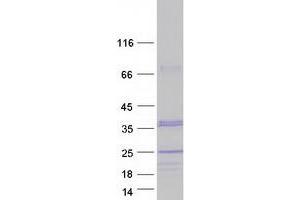 Image no. 1 for Charged Multivesicular Body Protein 1A (CHMP1A) (Transcript Variant 2) protein (Myc-DYKDDDDK Tag) (ABIN2713980)