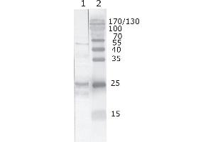 HIV-1 Tat antibody  (AA 71-81)