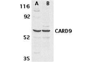 Image no. 2 for anti-Caspase Recruitment Domain Family, Member 9 (CARD9) antibody (ABIN499537)
