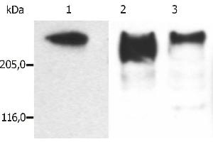 Western Blotting (WB) image for anti-Microtubule-Associated Protein 2 (MAP2) antibody (ABIN125739)