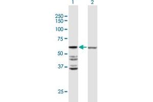 Image no. 1 for anti-Acyl-CoA Thioesterase 2 (ACOT2) (AA 1-483) antibody (ABIN1327486)